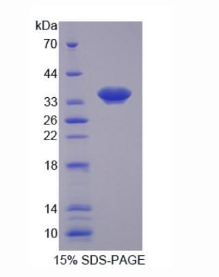 核膜含血影蛋白重復(fù)蛋白1(Nesp1)重組蛋白,Recombinant Nesprin 1 (Nesp1)