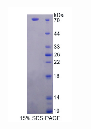 原卟啉原氧化酶(PPOX)重组蛋白,Recombinant Protoporphyrinogen Oxidase (PPOX)