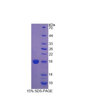 双特异性磷酸酶5(DUSP5)重组蛋白,Recombinant Dual Specificity Phosphatase 5 (DUSP5)