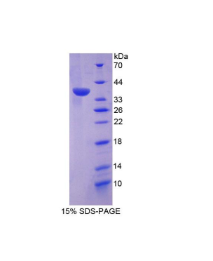 双特异性磷酸酶6(DUSP6)重组蛋白,Recombinant Dual Specificity Phosphatase 6 (DUSP6)