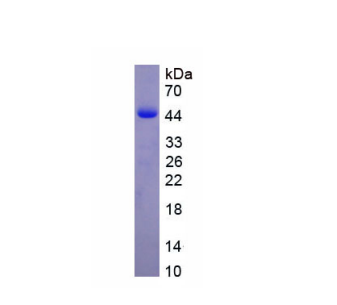 碘甲腺原氨酸脱碘酶Ⅲ(DIO3)重组蛋白,Recombinant Deiodinase, Iodothyronine, Type III (DIO3)