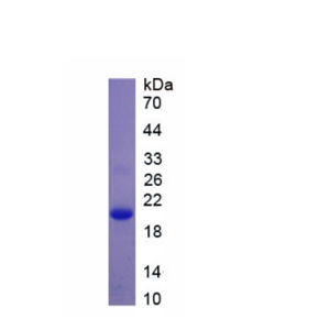 过氧化还原酶5(PRDX5)重组蛋白
