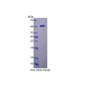跨膜丝氨酸蛋白酶4(TMPRSS4)重组蛋白,Recombinant Transmembrane Protease, Serine 4 (TMPRSS4)