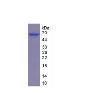 分泌粒蛋白Ⅲ(SCG3)重组蛋白