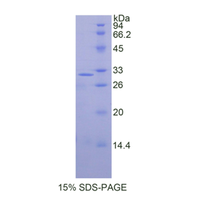 胞裂蛋白5(SEPT5)重组蛋白