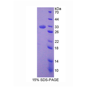 胞裂蛋白6(SEPT6)重组蛋白,Recombinant Septin 6 (SEPT6)