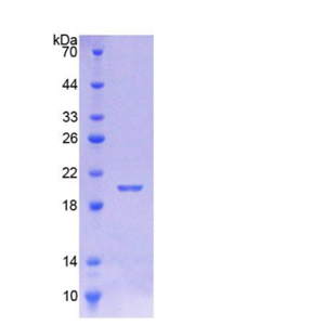 钙调蛋白样蛋白5(CALML5)重组蛋白