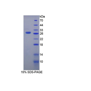 含硬化蛋白域蛋白1(SOSTDC1)重组蛋白