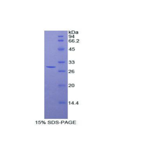 斯钙素2(STC2)重组蛋白