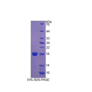 双特异性磷酸酶5(DUSP5)重组蛋白