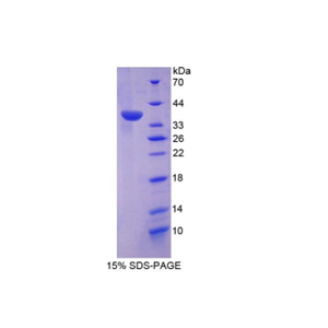 双特异性磷酸酶6(DUSP6)重组蛋白,Recombinant Dual Specificity Phosphatase 6 (DUSP6)