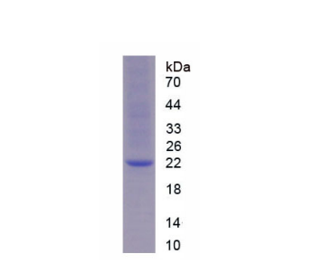 腺苷A2b受體(ADORA2b)重組蛋白,Recombinant Adenosine A2b Receptor (ADORA2b)