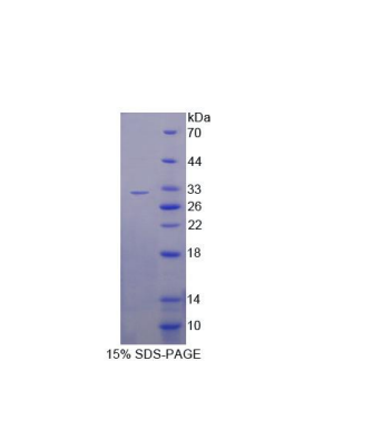 甲硫腺苷磷酸化酶(MTAP)重組蛋白,Recombinant Methylthioadenosine Phosphorylase (MTAP)