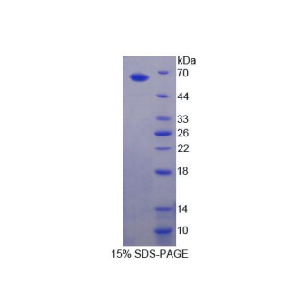 γ-氨基丁酸A受体α2(gABRa2)重组蛋白,Recombinant Gamma-Aminobutyric Acid A Receptor Alpha 2 (gABRa2)