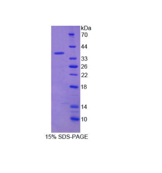 嘌呤能受體P2X7(P2RX7)重組蛋白,Recombinant Purinergic Receptor P2X, Ligand Gated Ion Channel 7 (P2RX7)