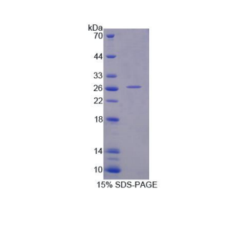 天冬氨酸β羥化酶(ASPH)重組蛋白,Recombinant Aspartate Beta Hydroxylase (ASPH)