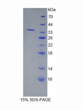 钙同线蛋白2(CLSTN2)重组蛋白,Recombinant Calsyntenin 2 (CLSTN2)