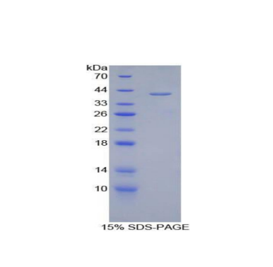 Corin蛋白(CRN)重组蛋白,Recombinant Corin (CRN)