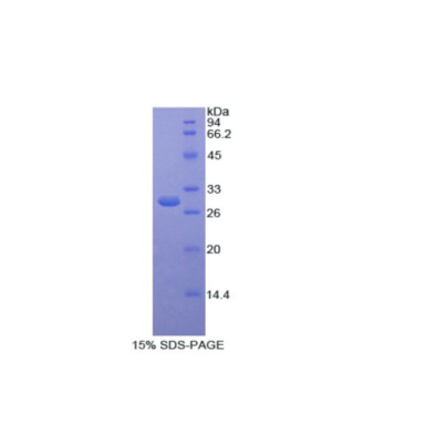 硒结合蛋白1(SELENBP1)重组蛋白,Recombinant Selenium Binding Protein 1 (SELENBP1)