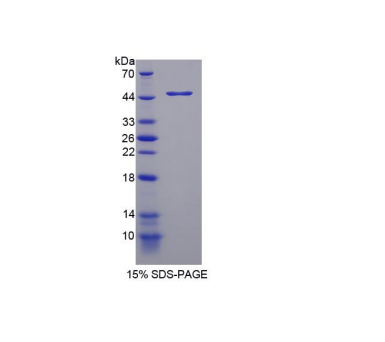 色氨酸羟化酶2(TPH2)重组蛋白,Recombinant Tryptophan Hydroxylase 2 (TPH2)