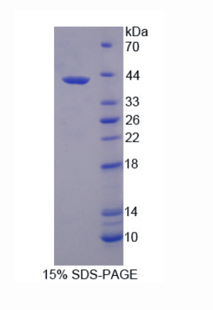 3-羟基丁酸脱氢酶1(BDH1)重组蛋白,Recombinant 3-Hydroxybutyrate Dehydrogenase 1 (BDH1)