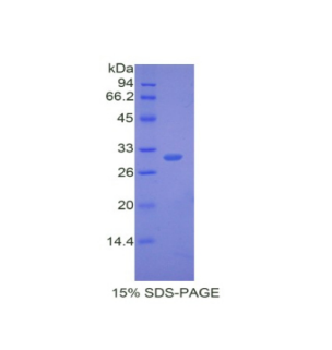 鈉/鉀離子轉(zhuǎn)運(yùn)ATP酶β1肽(ATP1b1)重組蛋白,Recombinant ATPase, Na+/K+ Transporting Beta 1 Polypeptide (ATP1b1)