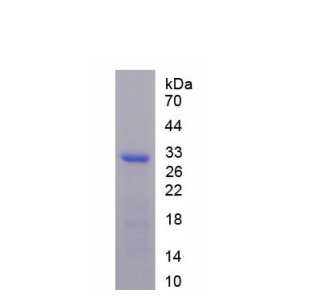 氫/鉀離子交換ATP酶β肽(ATP4b)重組蛋白,Recombinant ATPase, H+/K+ Exchanging Beta Polypeptide (ATP4b)