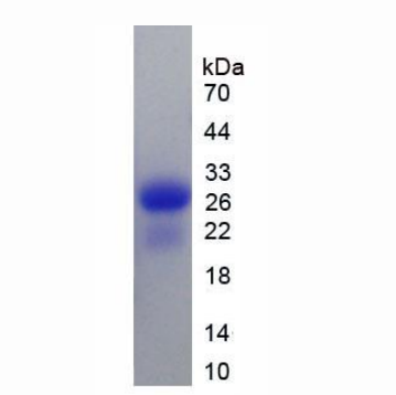 钙结合蛋白(CALB)重组蛋白,Recombinant Calbindin (CALB)