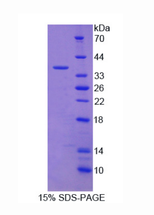 富酪蛋白(STATH)重组蛋白,Recombinant Statherin (STATH)