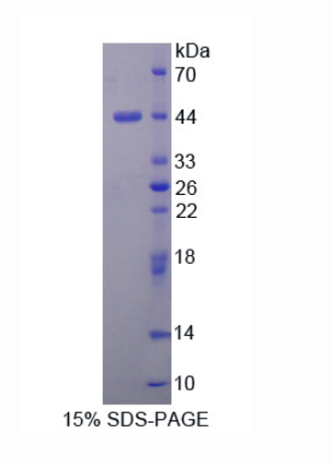 腦多巴胺神經(jīng)營養(yǎng)因子(CDNF)重組蛋白,Recombinant Cerebral Dopamine Neurotrophic Factor (CDNF)