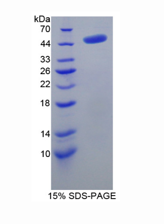 腺苷高半胱氨酸水解酶(AHCY)重组蛋白,Recombinant Adenosylhomocysteinase (AHCY)