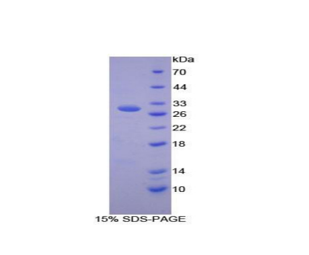 蛋氨酸腺苷转移酶Ⅱα(MAT2a)重组蛋白,Recombinant Methionine Adenosyltransferase II Alpha (MAT2a)