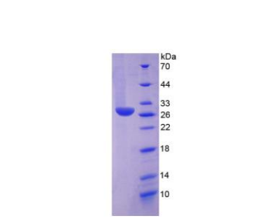 组氨酸脱羧酶(HDC)重组蛋白,Recombinant Histidine Decarboxylase (HDC)