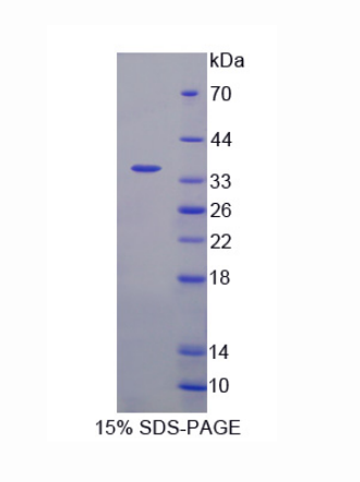 復(fù)制啟動(dòng)因子1(REPIN1)重組蛋白,Recombinant Replication Initiator 1 (REPIN1)