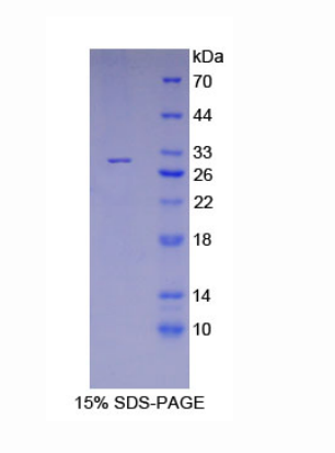 V-Yes-1 Yamaguchi肉瘤病毒相关癌基因同源物(LYN)重组蛋白,Recombinant V-Yes-1 Yamaguchi Sarcoma Viral Related Oncogene Homolog (LYN)