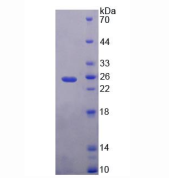 磷脂酰乙醇胺結(jié)合蛋白1(PEBP1)重組蛋白,Recombinant Phosphatidylethanolamine Binding Protein 1 (PEBP1)