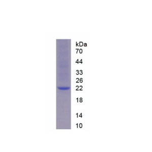 腺苷A2b受體(ADORA2b)重組蛋白,Recombinant Adenosine A2b Receptor (ADORA2b)