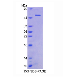 小脑肽1(CBLN1)重组蛋白,Recombinant Cerebellin 1 (CBLN1)