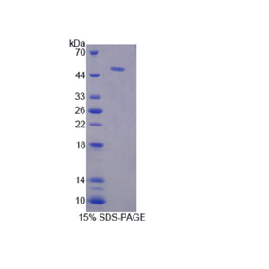磷酸甘油酸酯激酶1(PGK1)重组蛋白
