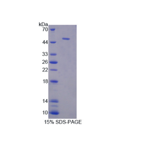 磷酸甘油酸酯激酶1(PGK1)重组蛋白,Recombinant Phosphoglycerate Kinase 1 (PGK1)