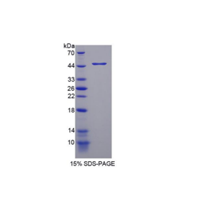 色氨酸羟化酶2(TPH2)重组蛋白,Recombinant Tryptophan Hydroxylase 2 (TPH2)