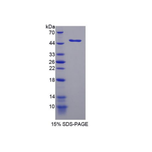 溶血卵磷脂酰基转移酶1(LPCAT1)重组蛋白