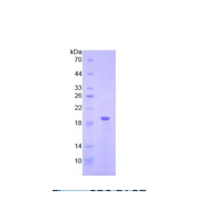 溶血卵磷脂酰基转移酶3(LPCAT3)重组蛋白