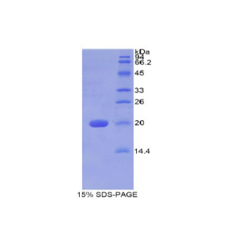 半乳糖神經(jīng)酰胺酶(GALC)重組蛋白,Recombinant Galactosylceramidase (GALC)