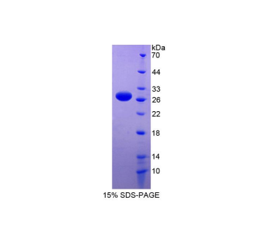 RNA结合基元蛋白38(RBM38)重组蛋白,Recombinant RNA Binding Motif Protein 38 (RBM38)