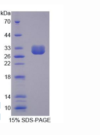 氯离子通道辅助蛋白1(CLCA1)重组蛋白,Recombinant Chloride Channel Accessory 1 (CLCA1)