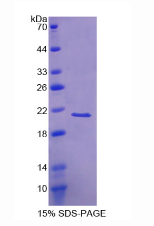 视锥蛋白样蛋白1(VSNL1)重组蛋白,Recombinant Visinin Like Protein 1 (VSNL1)