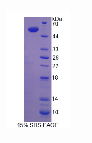 RNA聚合酶轉(zhuǎn)錄終止因子Ⅰ(TTF1)重組蛋白,Recombinant Transcription Termination Factor, RNA polymerase I (TTF1)