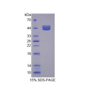 轉(zhuǎn)鈷胺素蛋白Ⅰ(TCN1)重組蛋白,Recombinant Transcobalamin I (TCN1)