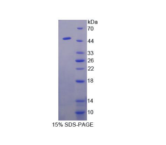 鈷胺傳遞蛋白Ⅱ(TCN2)重組蛋白,Recombinant Transcobalamin II, Macrocytic Anemia (TCN2)